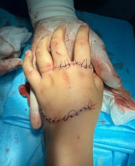 Тяжелую травму руки получила 9-летняя девочка в одном из развлекательных центров Актобе