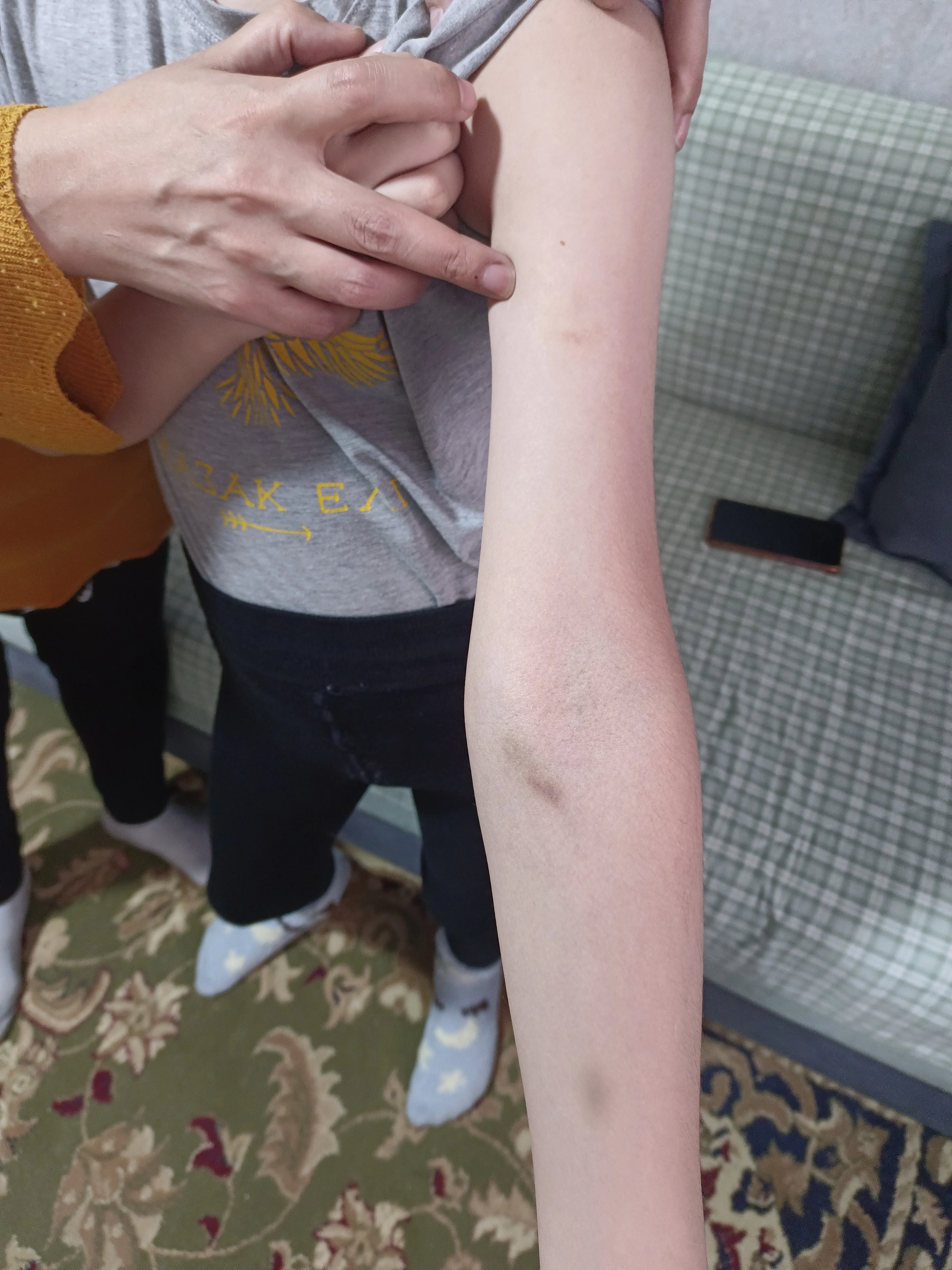 В Актобе женщина заявила, что ее сына с инвалидностью избивали в больнице